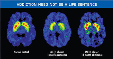 Photo Credit: National Institute of Drug Abuse