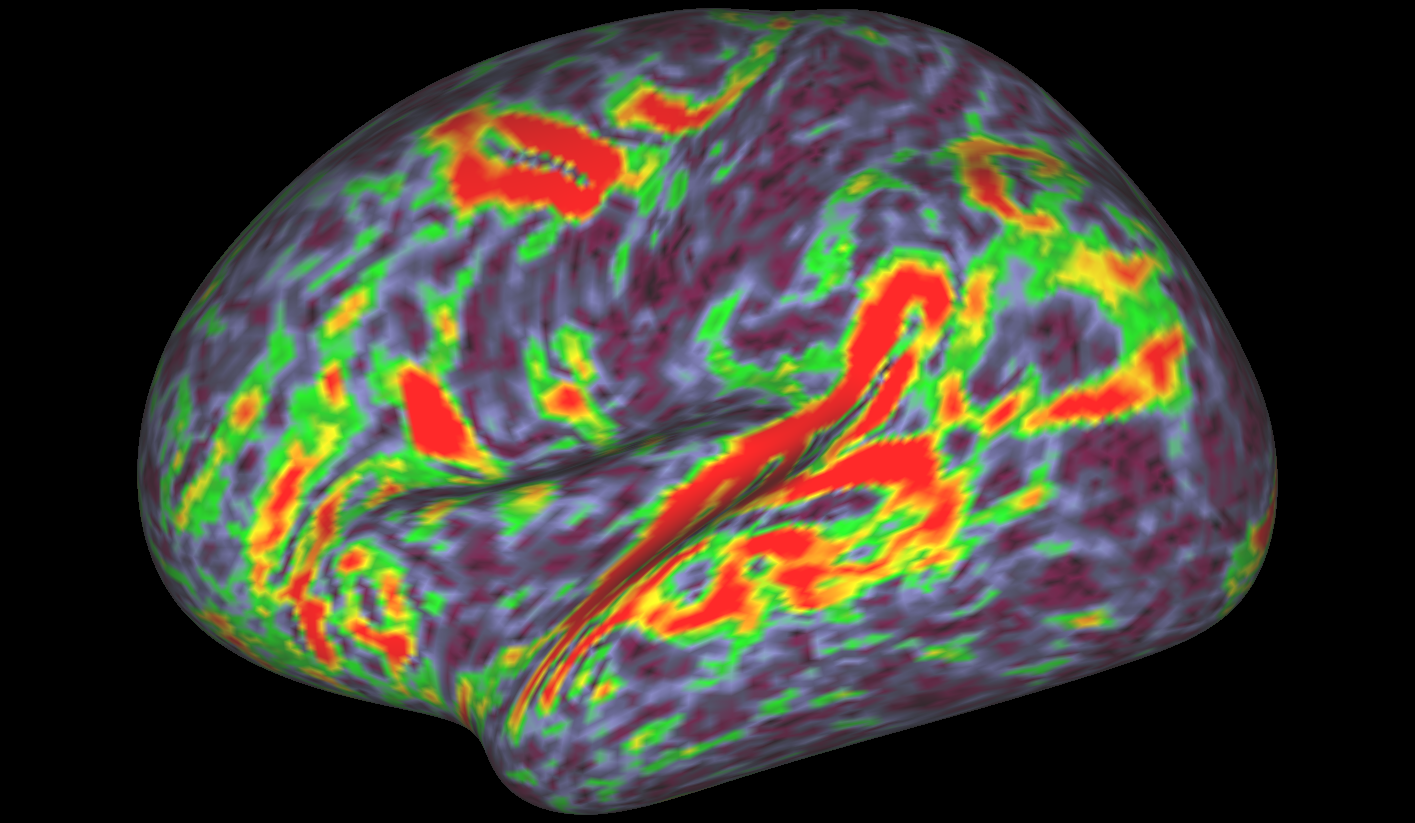 To map the human brain at an unprecedented level of detail, researchers combined brain-mapping techniques that had previously been used only separately, including task-based functional magnetic resonance imaging (fMRI). Shown here is evidence for different areas of brain activation in a language task, as measured by fMRI.  Credit: Matthew Glasser, Ph.D., and David Van Essen, Ph.D., Washington University